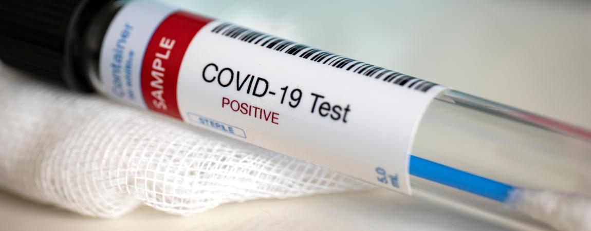 COVID Test Vial